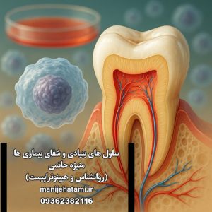مزایای DPSCs ، بانک‌داری سلولی،درمان بیماری‌های انسانی ، کارآزمایی بالینی، بازسازی استخوان ، پالپ دندان عقل ،DPSC